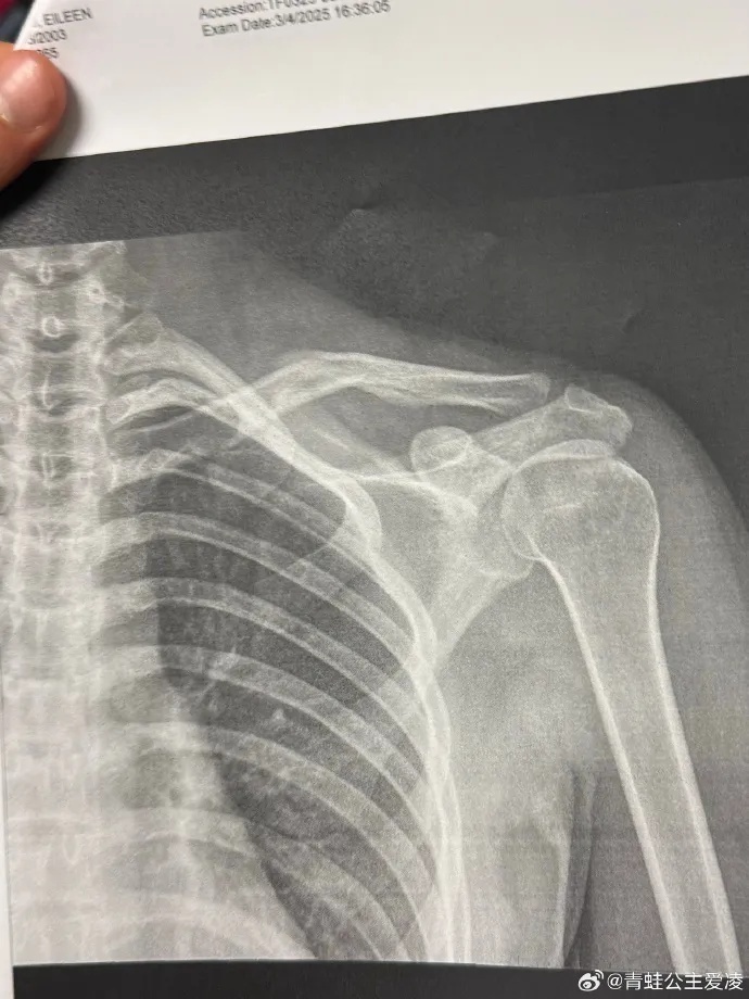 自己在受伤, 谷爱凌发文, 岁成为了全