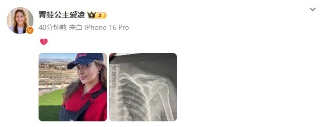 ABZB, 坡面障碍技